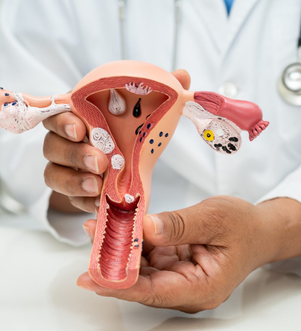 doencas-ginecologicas-2